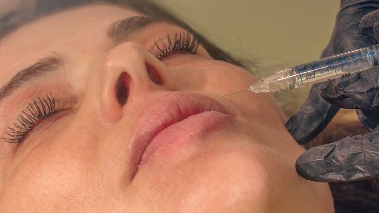 lipfillersillegaal_14mrt19.jpg lipfillersillegaal_14mrt19.jpg