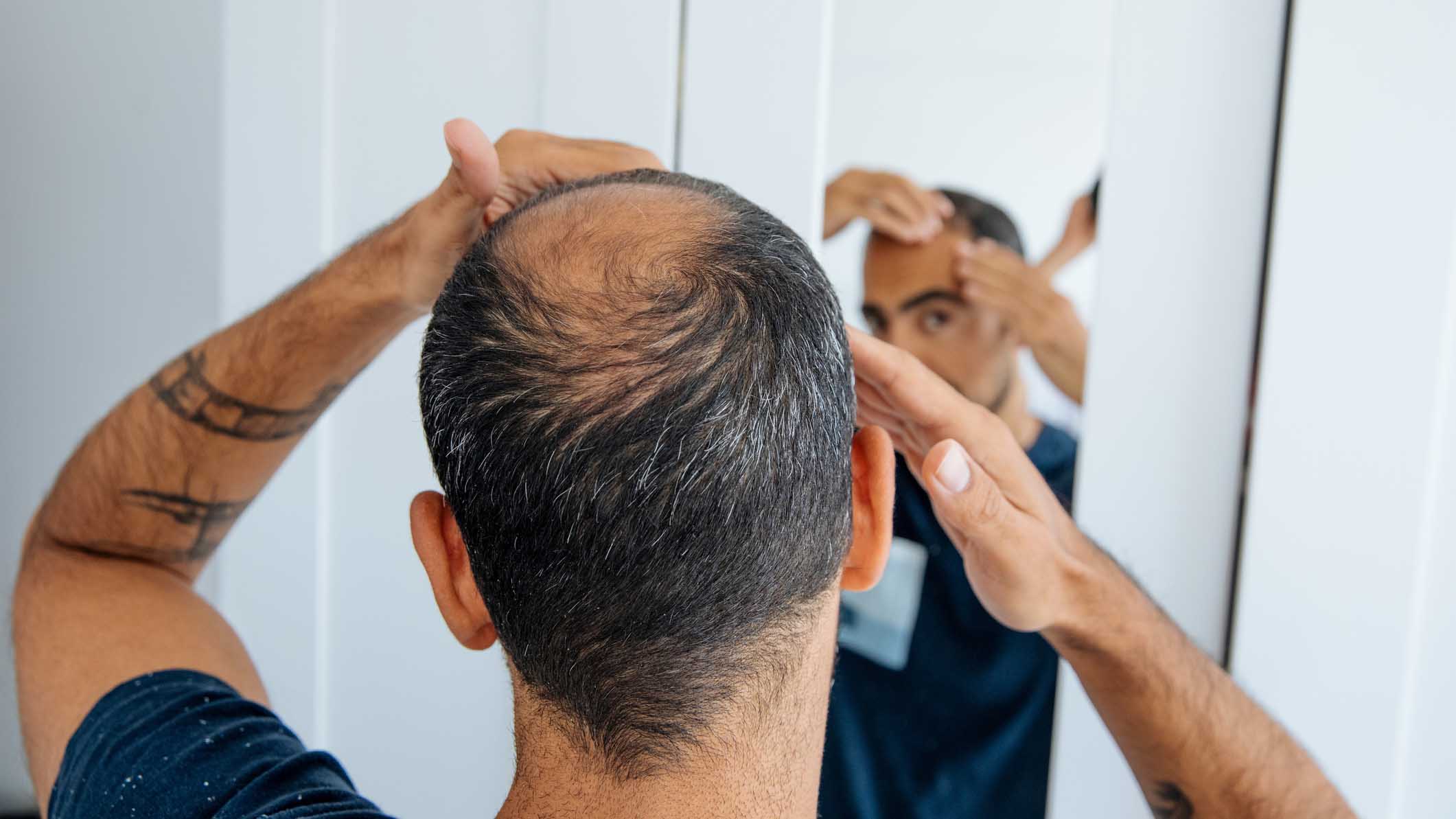 Kaal Maar Niet Kansloos Kaal Maar Niet Kansloos