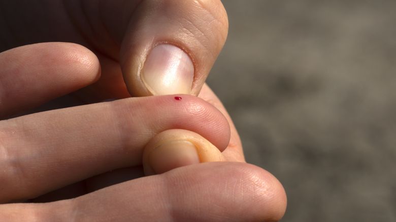 splinter site.jpg splinter site.jpg