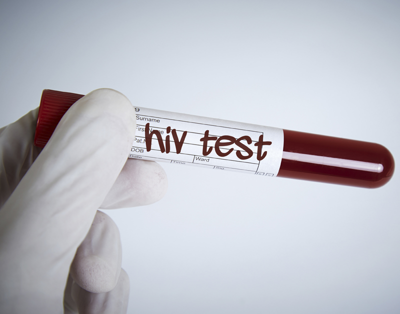 hiv_test_800.jpg hiv_test_800.jpg