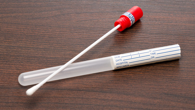 groei-commerciele-dna-testen-baart-zorgen-26022019.jpg groei-commerciele-dna-testen-baart-zorgen-26022019.jpg