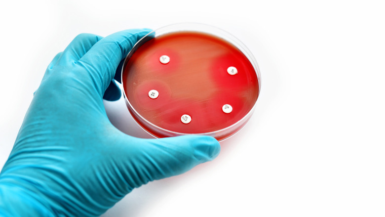 mrsa-20190829.jpg mrsa-20190829.jpg