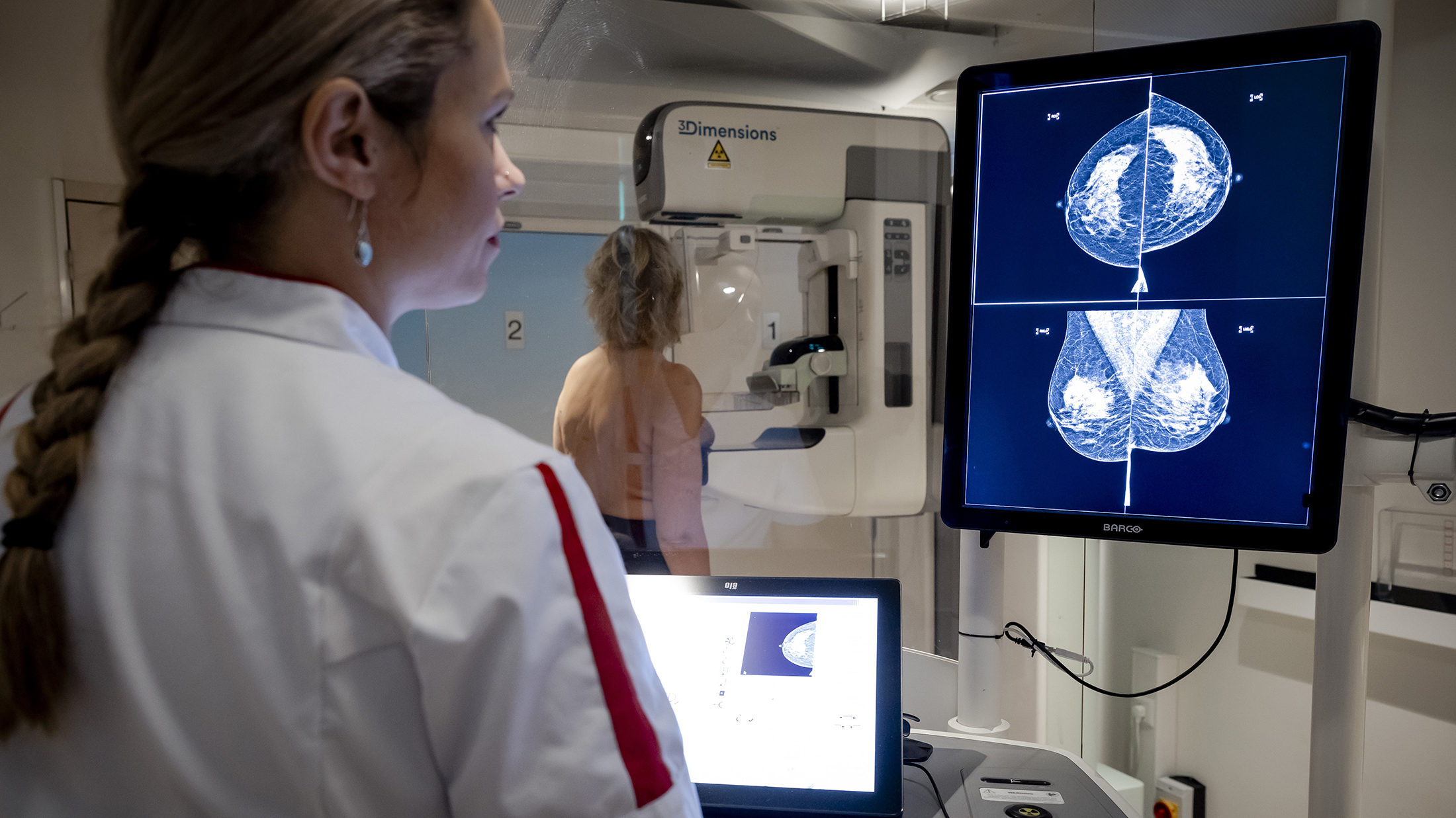 Borstonderzoek Klein