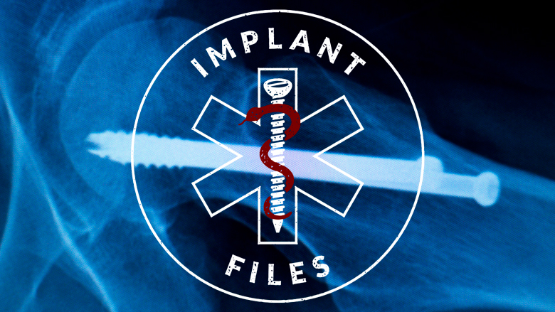 implantfiles-wob-achterhouden-informatie-201218.jpg implantfiles-wob-achterhouden-informatie-201218.jpg