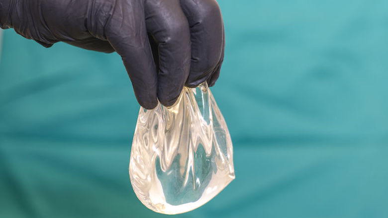 20200611 borstimplantaat.jpg