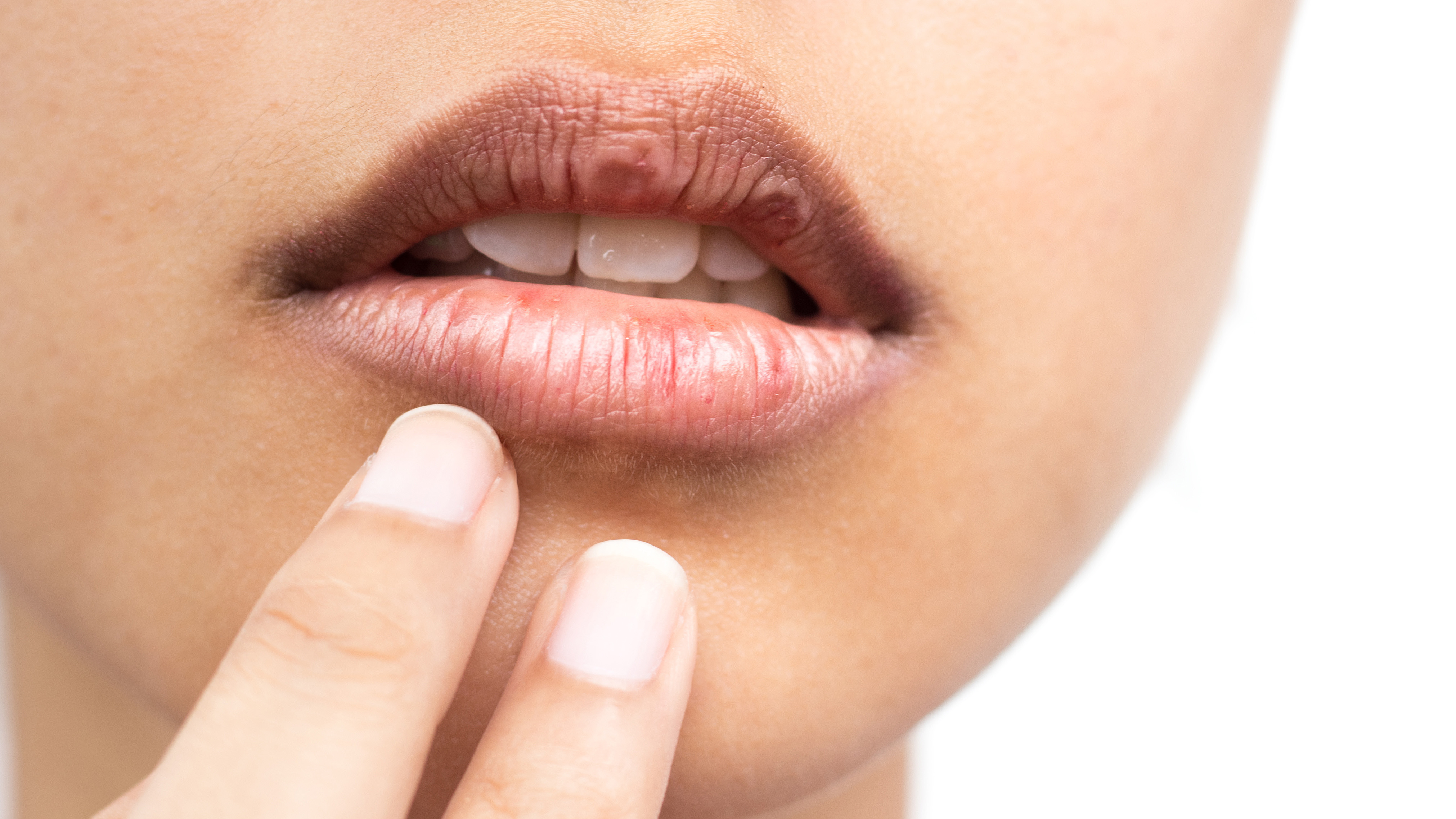 droge-lippen-dvm-27102020.jpg droge-lippen-dvm-27102020.jpg