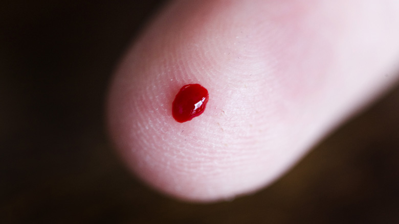 780x439_suikerziekte.jpg 780x439_suikerziekte.jpg