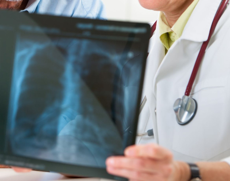 longkanker_diagnose_uitleg_arts_800.jpg longkanker_diagnose_uitleg_arts_800.jpg