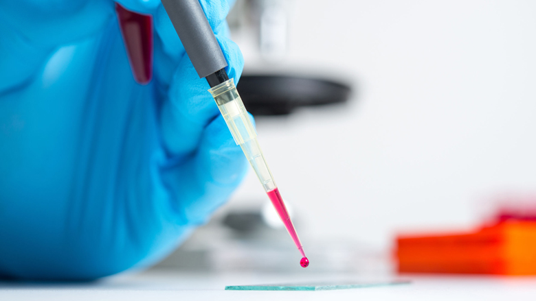 bloedtest-genetischeziekten-170825.jpg bloedtest-genetischeziekten-170825.jpg