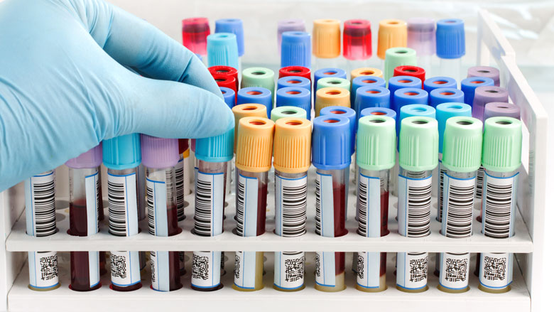 drugs-test-werk-24052019.jpg drugs-test-werk-24052019.jpg