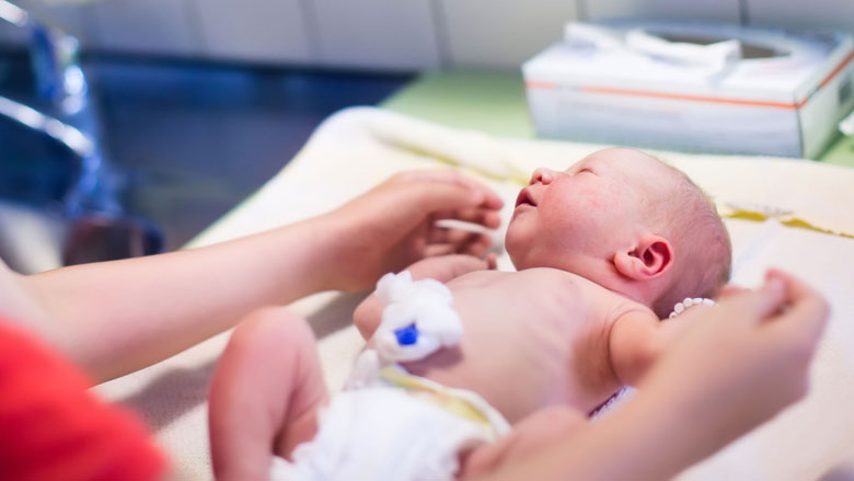 baby-navelstreng07062017.jpg baby-navelstreng07062017.jpg