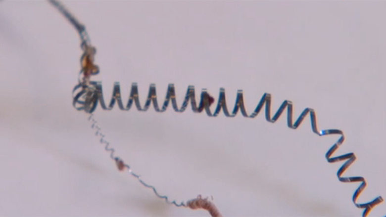 essure-sterillisatie-veertje-28112018.jpg essure-sterillisatie-veertje-28112018.jpg