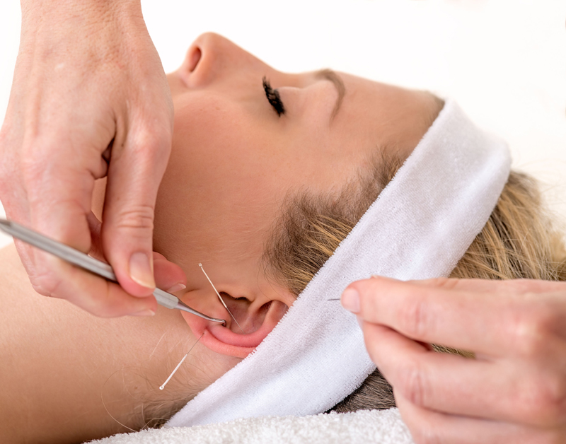 accupunctuur.jpg