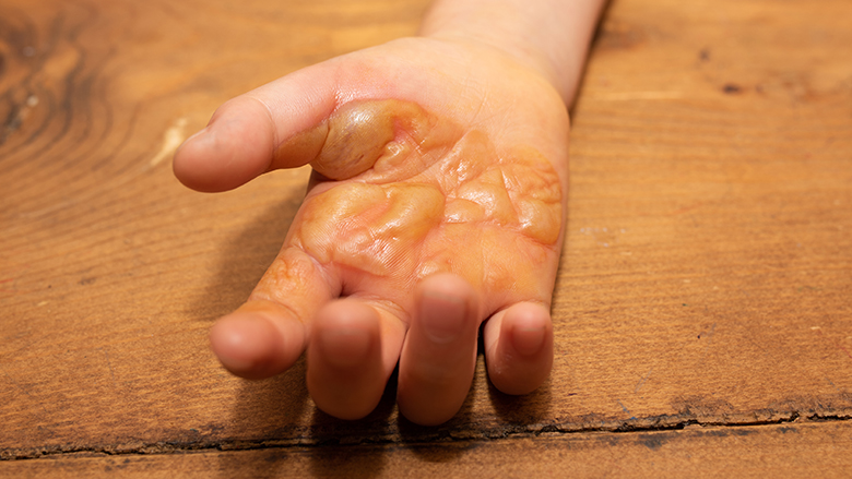 140722_brandblaar site.jpg