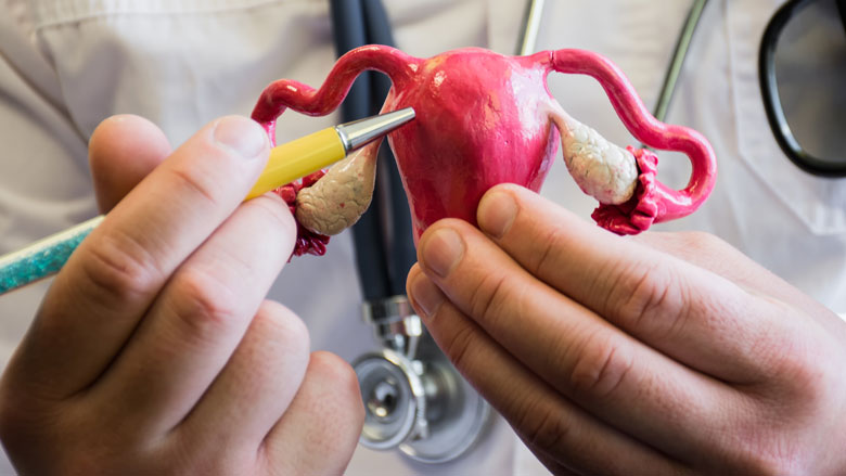 endometriose-09042019.jpg endometriose-09042019.jpg