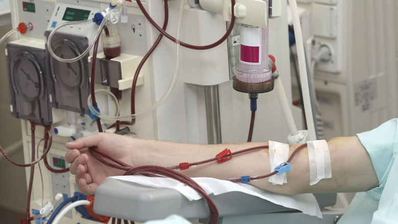 dialyse_780.jpg dialyse_780.jpg