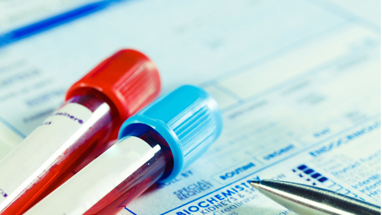 leukemie-780.jpg leukemie-780.jpg