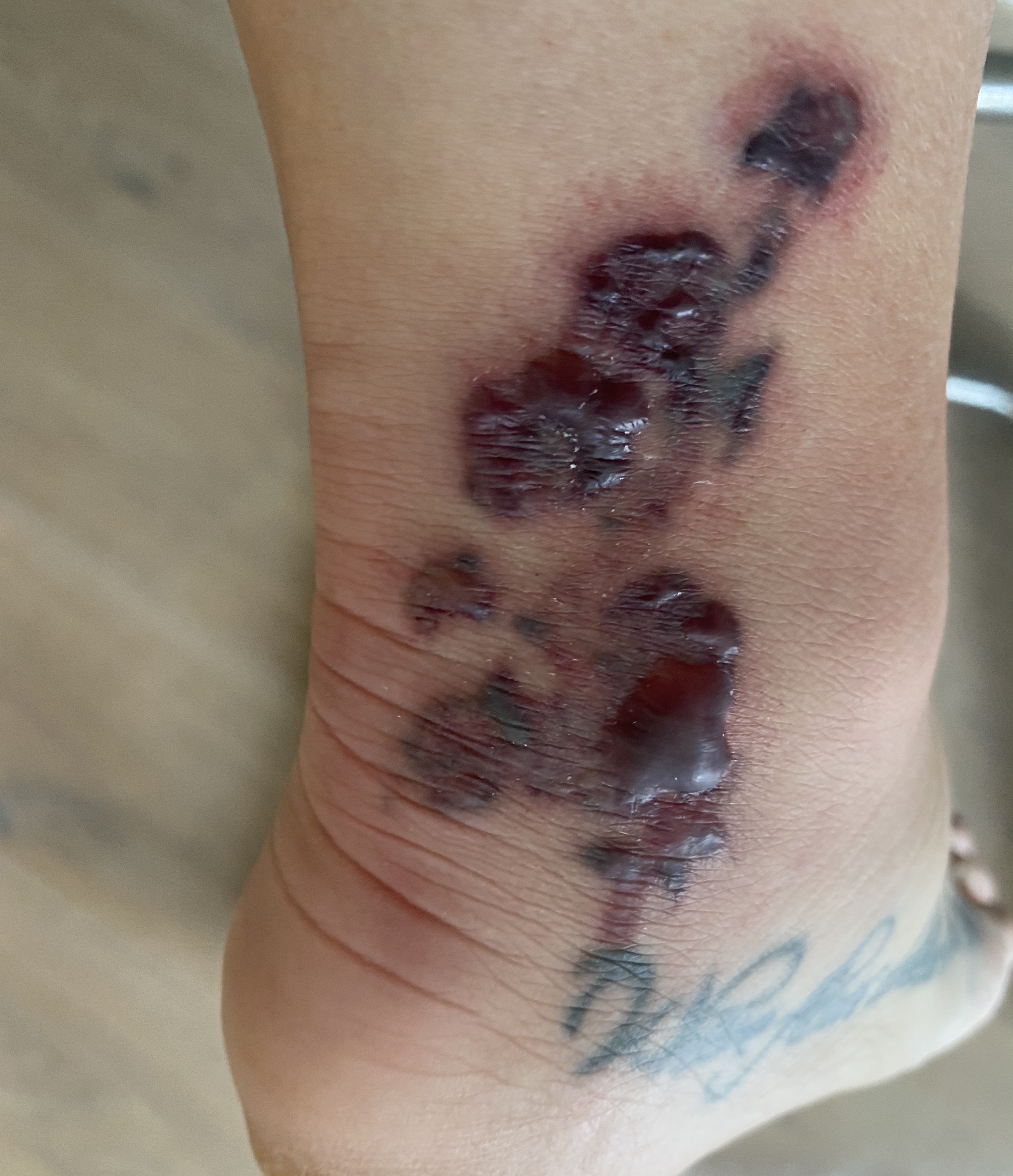 E11b5eb79e944c639f1656b49806e14d Jpg