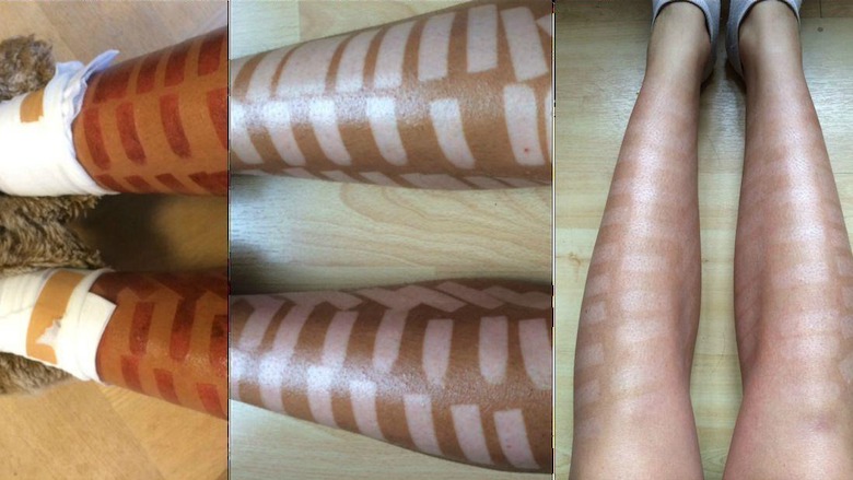 De 7 Meest Gestelde Vragen Over Laser Ontharen - Laserontharing Hasselt, Genk - SoCleanClinic.be thumbnail