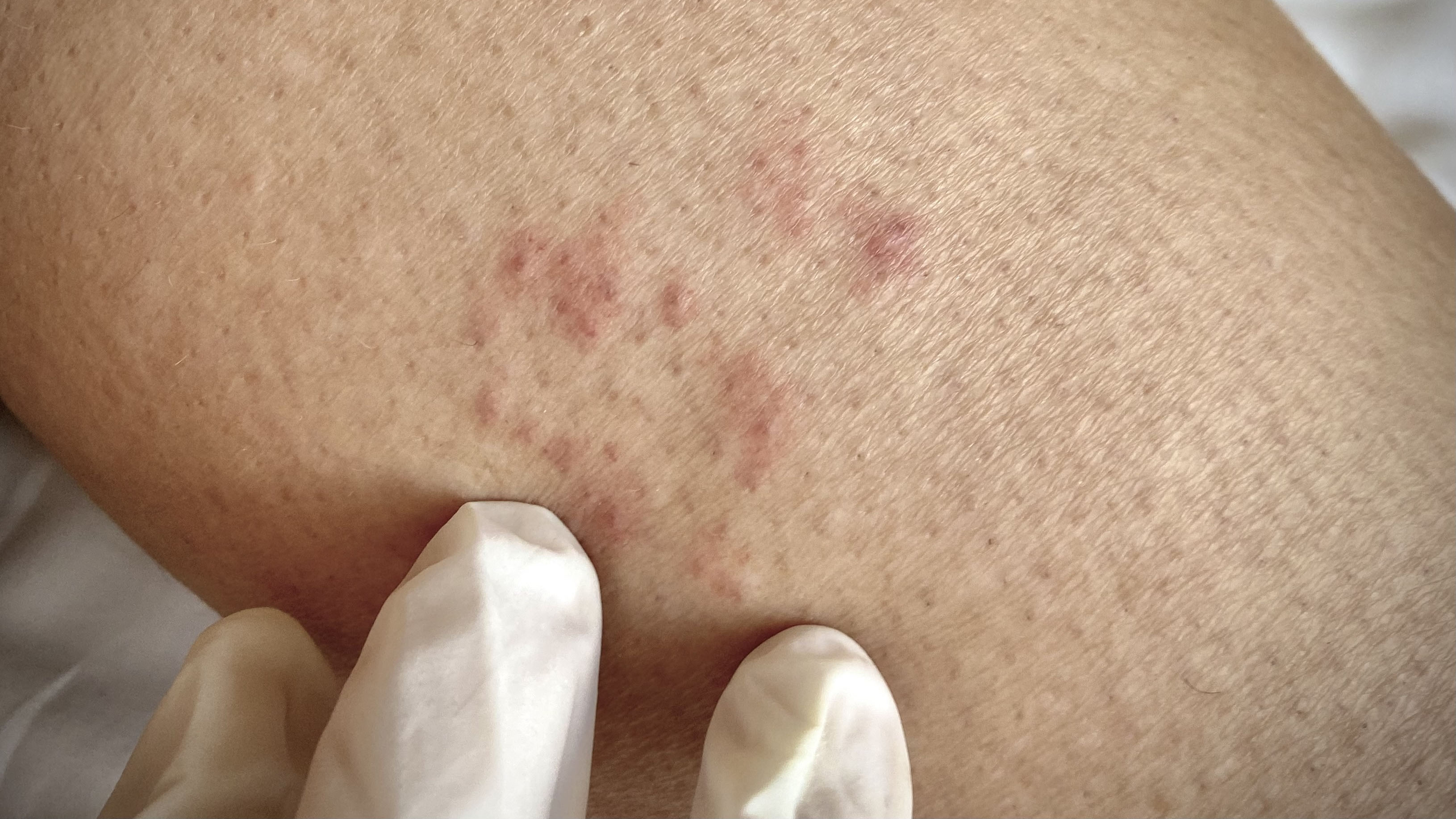 Gordelroos Afbeelding