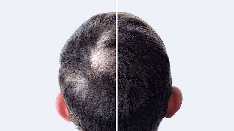 16022021 kale kruin.jpg