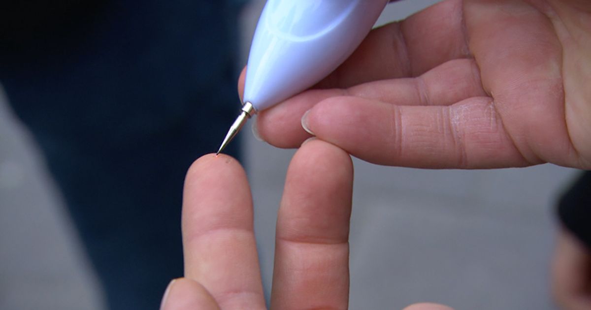 Thuis Moedervlek Verwijderen: Veilige en Effectieve Methoden