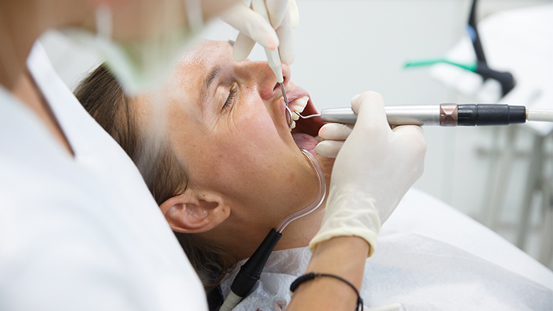 160522 tandvlees.jpg