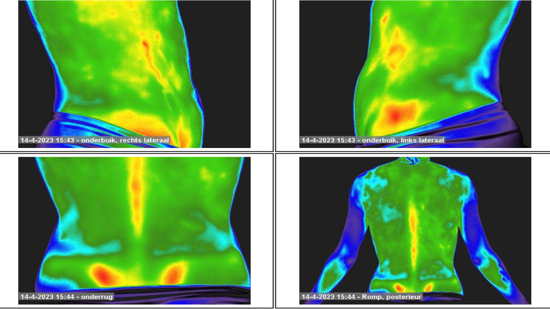thermografieselectie.png thermografieselectie.png