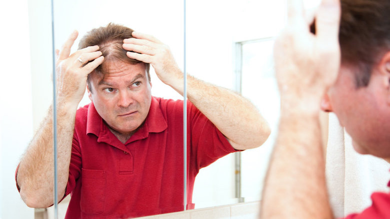21-11-19-haaruitval-haarverlies-kaal-shampoo-dun-haar-cafeine-testosteron-dht-14943207_s.jpg 21-11-19-haaruitval-haarverlies-kaal-shampoo-dun-haar-cafeine-testosteron-dht-14943207_s.jpg