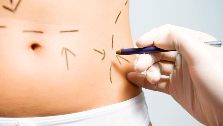 plastische-chirurgie-780.jpg plastische-chirurgie-780.jpg