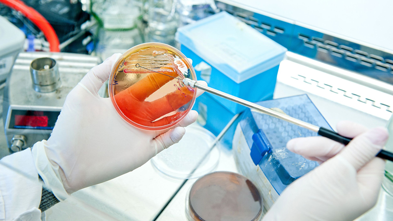 e_coli_123rf_780.jpg e_coli_123rf_780.jpg