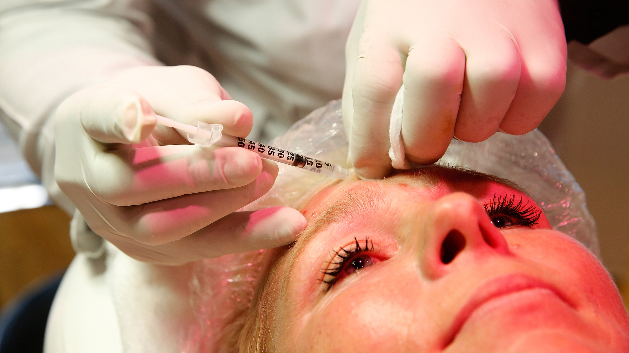 Botox Behandleing