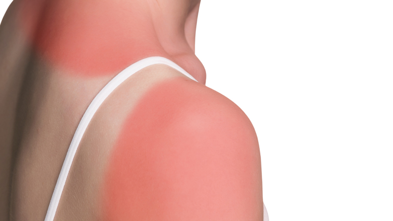 zonkracht-rivm-19-04-2018--780.jpg zonkracht-rivm-19-04-2018--780.jpg